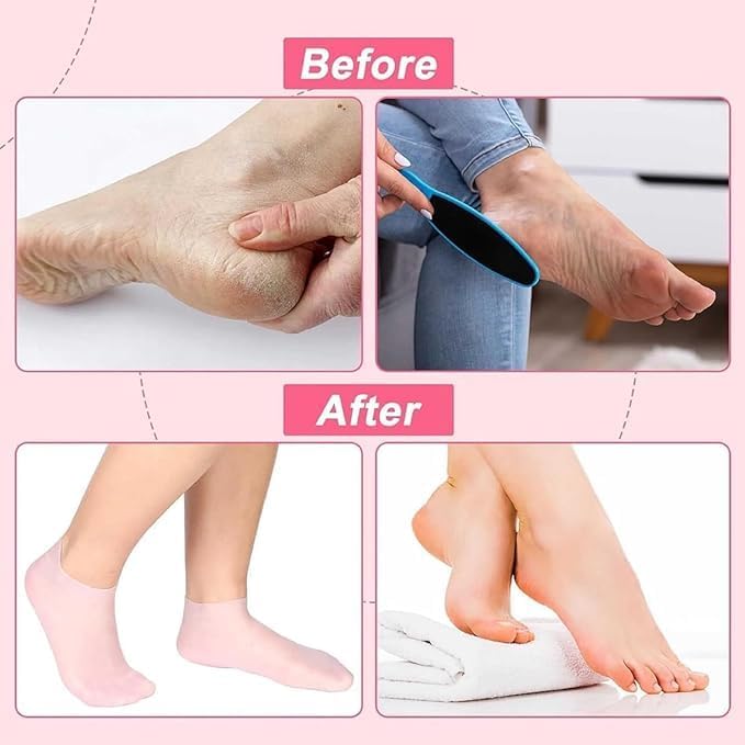 Anti Slip Silicon Gel Socks